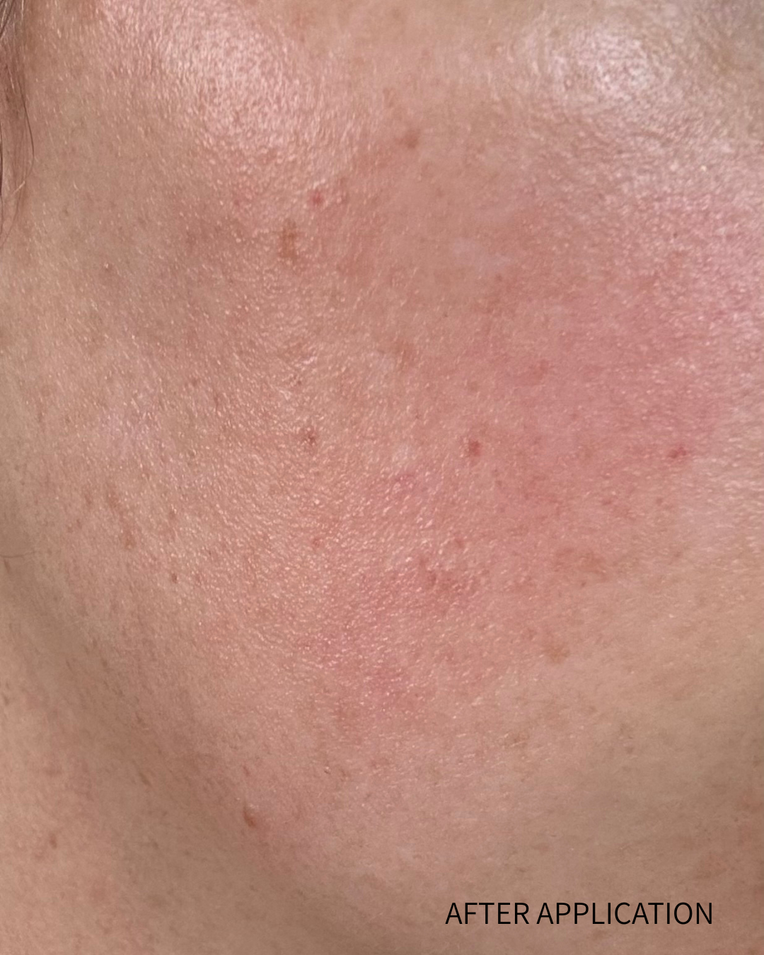 Skin texture after application with visible redness