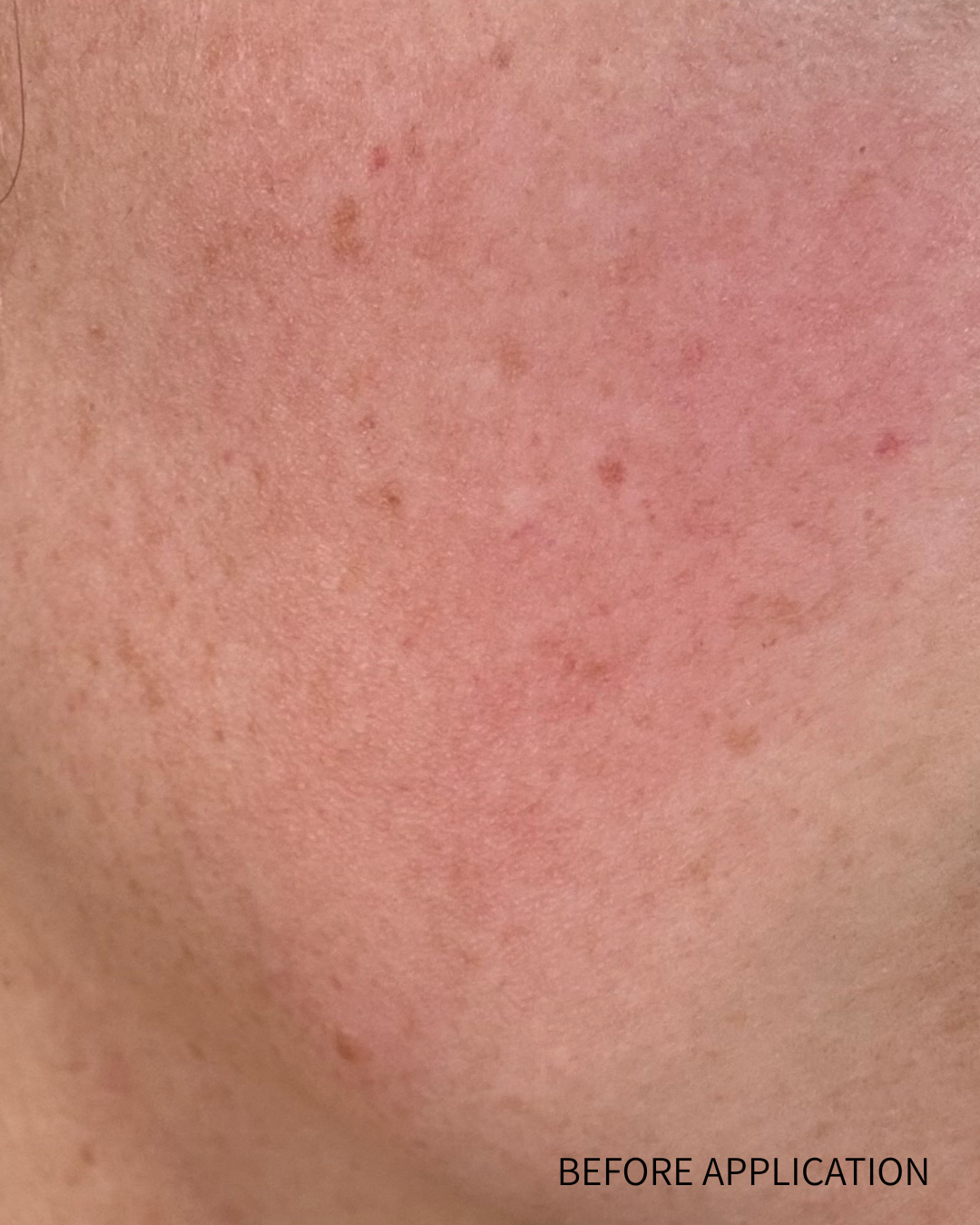 Skin texture before application with 'Before Application' text