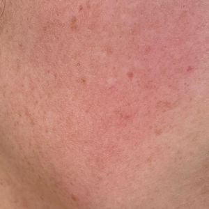 Skin texture before application with 'Before Application' text