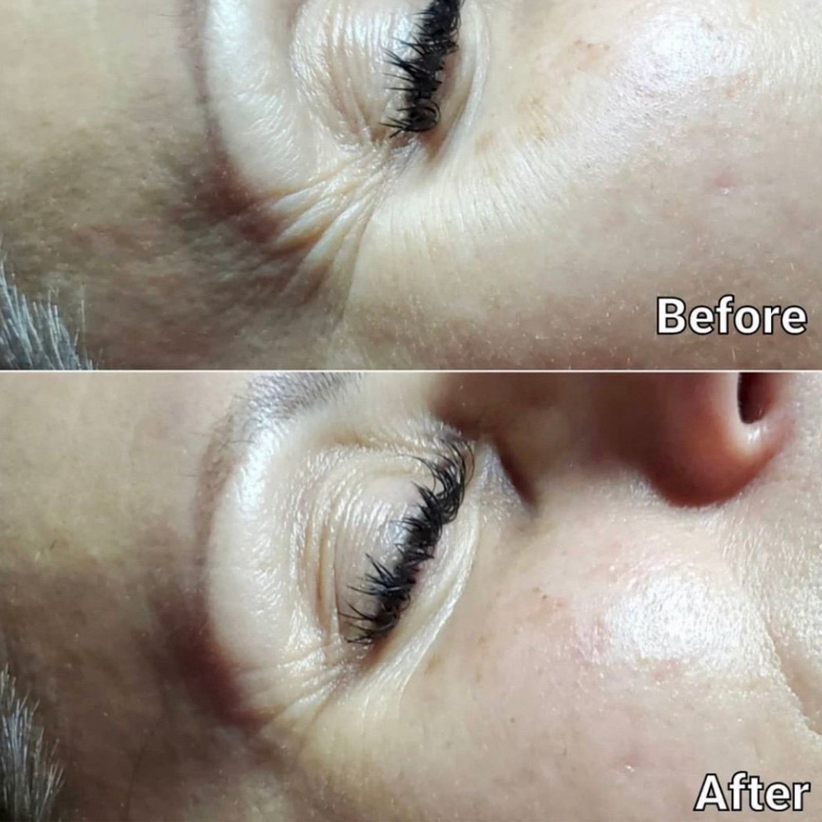Before and After Visuals After Using Dramatic Eye Lift
