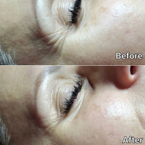 Before and After Visuals After Using Dramatic Eye Lift